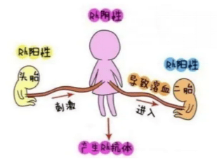 abo溶血症的孩子能要吗,关于abo溶血症孩子能否要养的全面分析说明,整体讲解规划_Tablet94.72.64