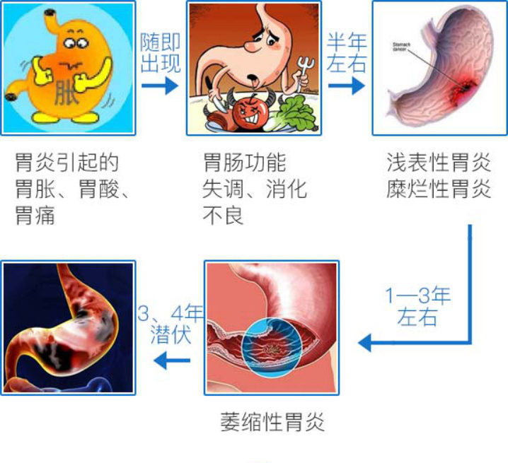 口臭去药店买三种药幽门螺杆菌