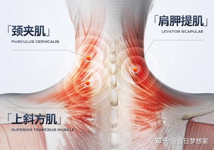 护肘关节护套怎么用,护肘关节护套的使用方法和科学研究解析说明,可靠计划策略执行_限量版36.12.29