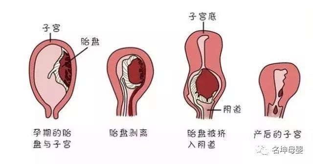 生物网片治疗子宫脱垂