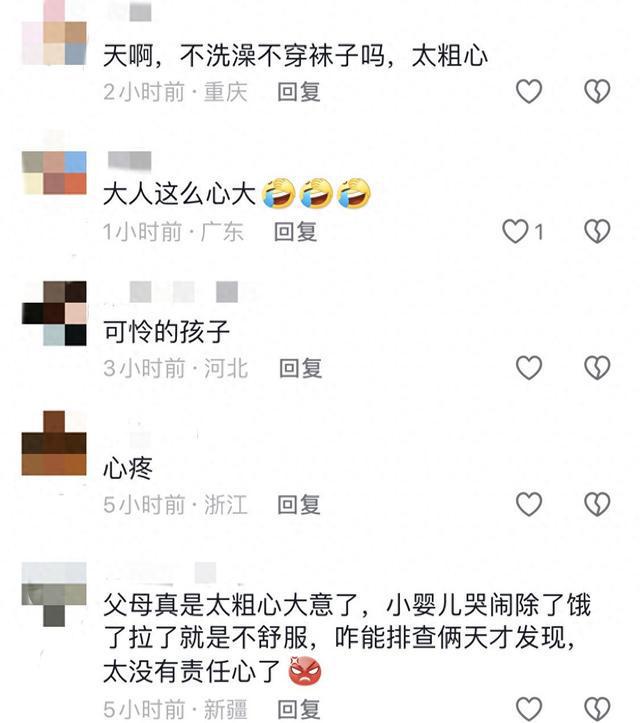 女婴两天哭闹不止竟因头发丝绕脚趾